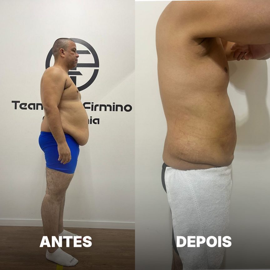 Antes e depois de aluno do Team Léo Firmino, resultado 6